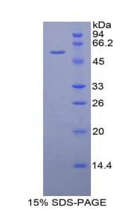 Mouse ACKR1 / DARC Protein (Recombinant His-GST)