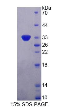 Human PLIN4 / S3-12 Protein (Recombinant His-T7, N-terminus)