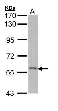 Polyclonal Rabbit anti-Human RICK / RIP2 Antibody (WB)