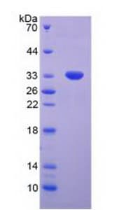 Mouse TP53 / p53 Protein (Recombinant His)