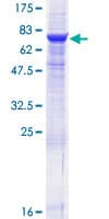Human CD39 Protein (Recombinant GST)
