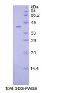 Human CSF2RB / CD131 Protein (Recombinant His-GST)