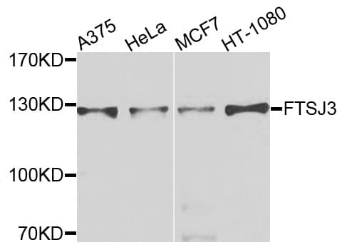 Polyclonal Rabbit anti-Human FTSJ3 Antibody (WB)