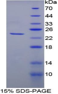 Pig HMOX1 / HO-1 Protein (Recombinant His-S)