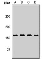 PLB1 Antibody