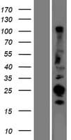 CABP / CABP1 Protein (Over-Expression Lysate Myc-DDK (Flag))