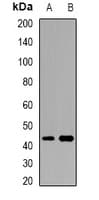 ACTR3B / ARP4 Antibody