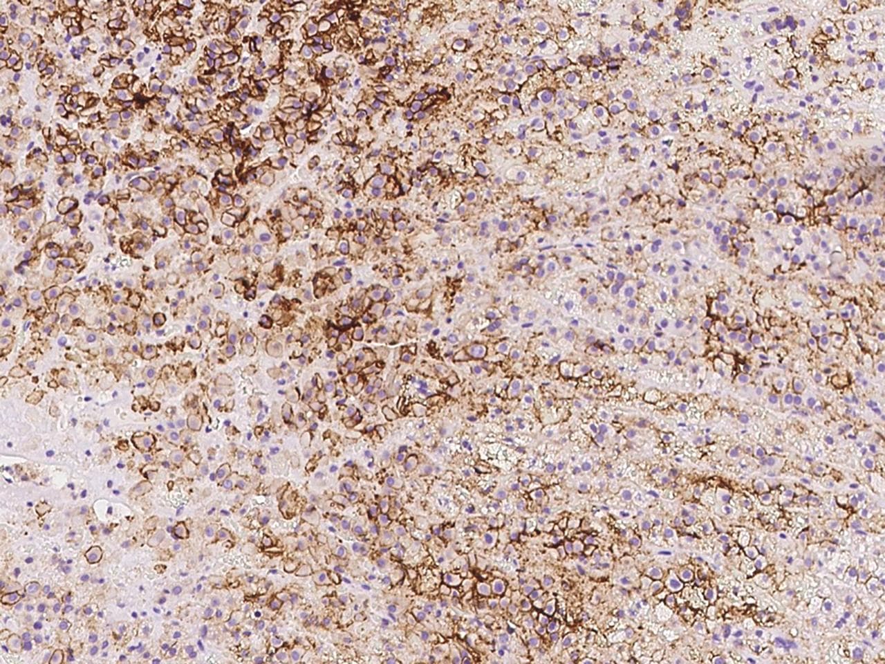 SLC1A4 / ASCT1 Antibody