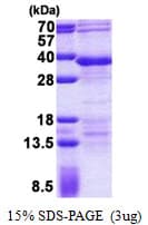 Human RFXANK Protein (Recombinant His)