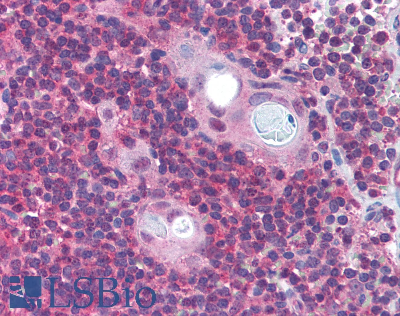 IHC-plus™ PAFAH1B1 / LIS1 Antibody