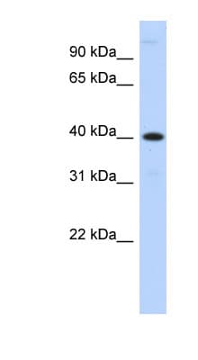 Polyclonal Rabbit anti-Human MPPE1 / PGAP5 Antibody (aa107-156, WB)