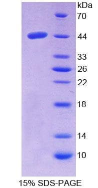Human NPC2 Protein (Recombinant His-GST)
