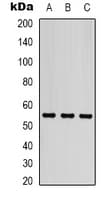TUBB3 / Tubulin Beta 3 Antibody