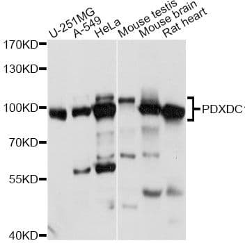 Polyclonal Rabbit anti-Human PDXDC1 Antibody (WB)