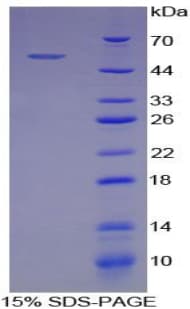 Pig SELE / CD62E / E-selectin Protein (Recombinant His-GST)
