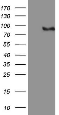 MALT1 Antibody (clone OTI6C11)