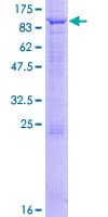 Human CFAP52 / WDR16 Protein (Recombinant GST)
