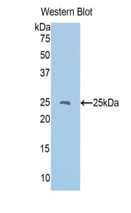 CD8A / CD8 Alpha Antibody (aa26-236)