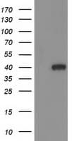 HAO1 Antibody (clone OTI6B3, Carrier-free)