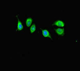 KIAA1267 Antibody