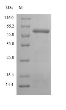 Human PPOX Protein (Recombinant 6His-SUMO, N-terminus)