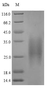 Vaccinia Virus Smallpox-B5R Protein (Recombinant 6His, N-terminus)