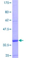 Human CCL22 / MDC Protein (Recombinant GST)