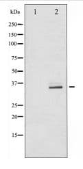 Polyclonal Rabbit anti-Human CDK5 Antibody (IHC, WB)