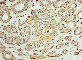 CCT6A Antibody (aa80-250)