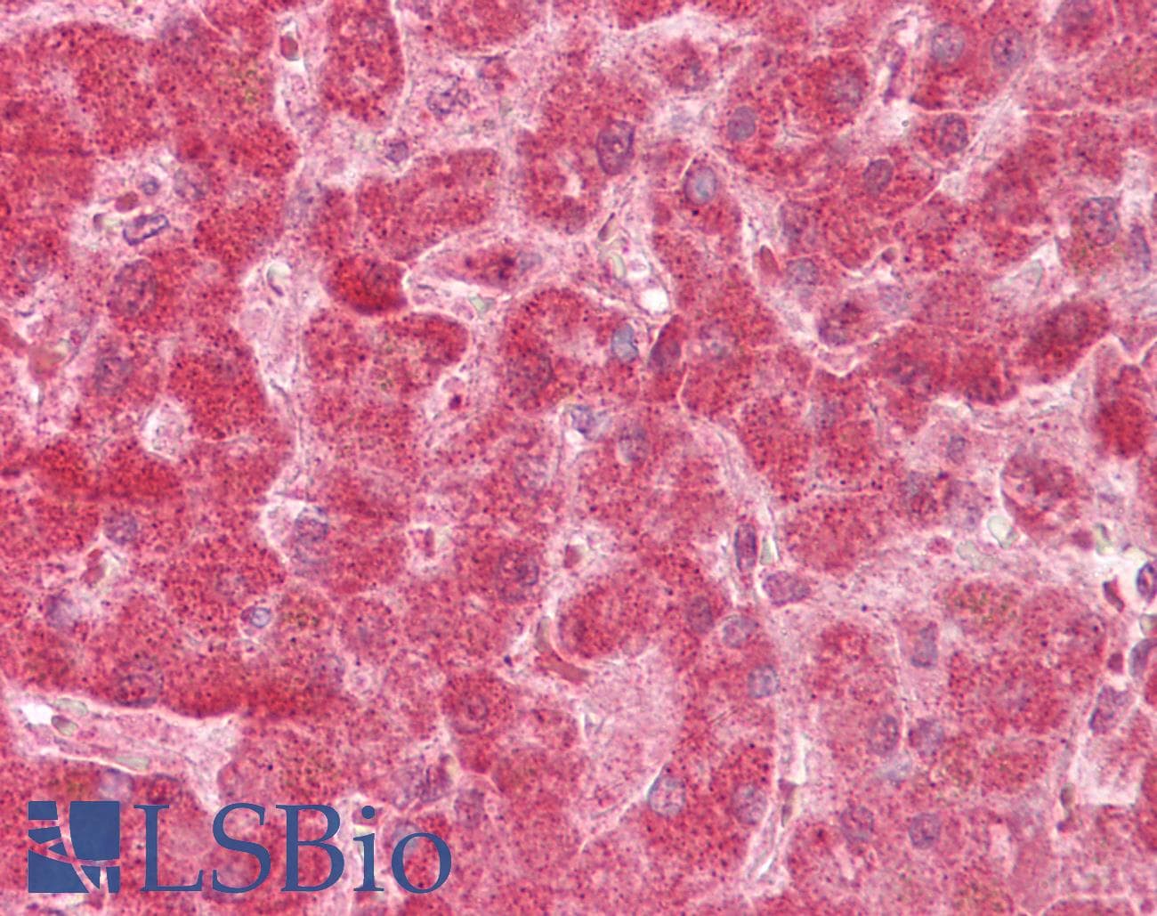 IHC-plus™ Polyclonal Rabbit anti-Human FIS1 Antibody (aa11-25, IHC, WB)