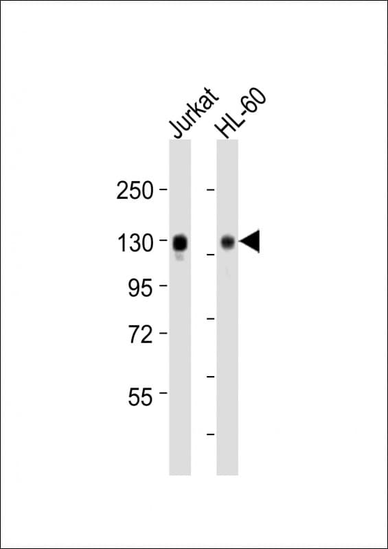 SEMA4D / Semaphorin 4D / CD100 Antibody (aa793-832)