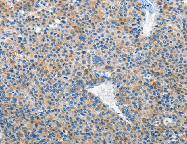 Polyclonal Rabbit anti-Human EPHB3 / EPH Receptor B3 Antibody (IHC)