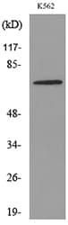 TF / Transferrin Antibody