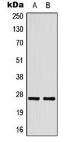 Polyclonal Rabbit anti-Human HSPB1 / HSP27 Antibody (Internal, IHC, WB)