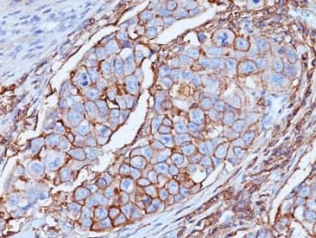 Monoclonal Mouse anti-Human CD44 Antibody (clone DF1485, IHC, IF, WB)
