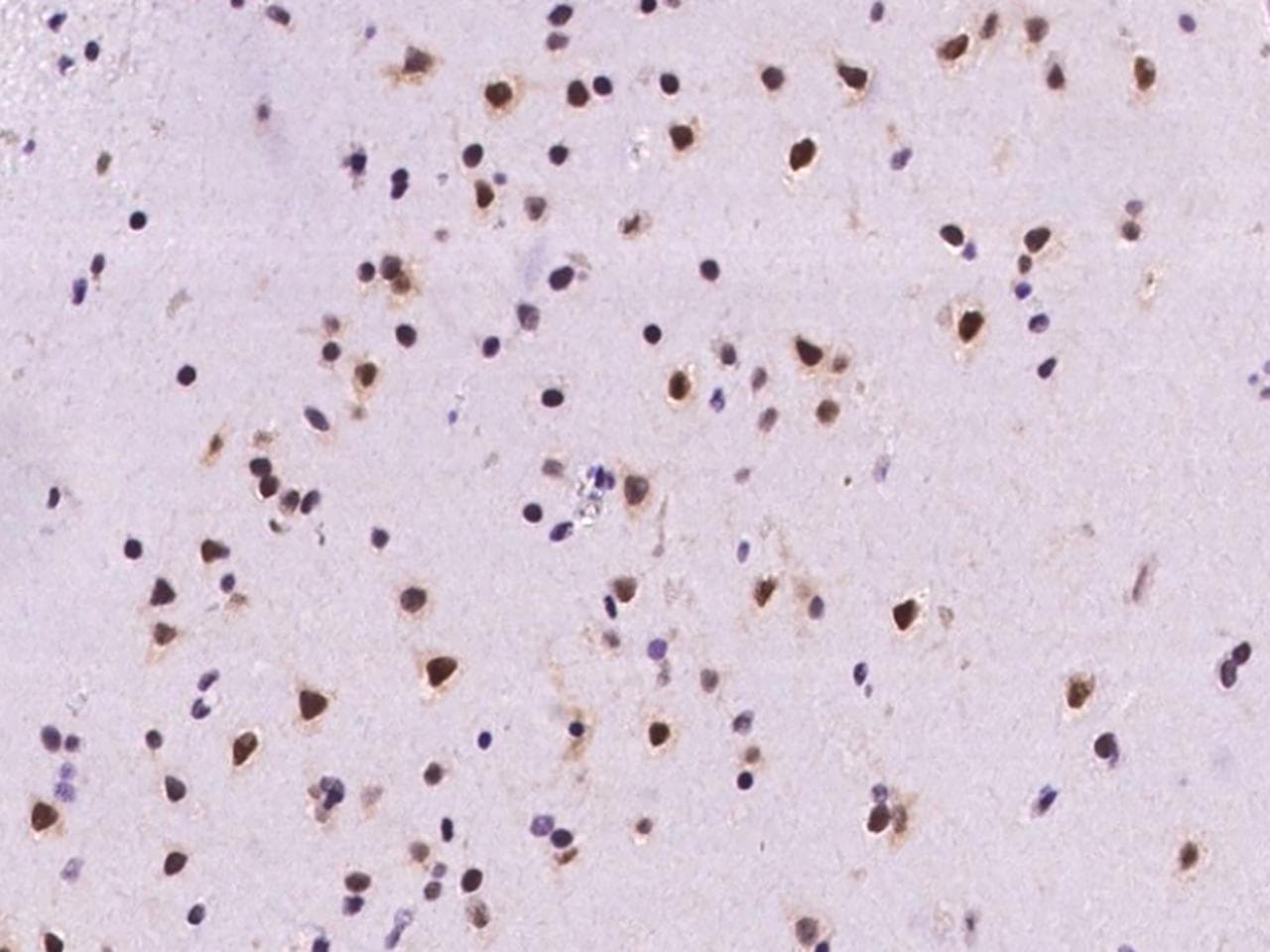 ARGLU1 Antibody