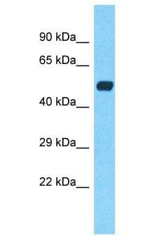 Polyclonal Rabbit anti-Human CHRNA7 Antibody (aa424-473, WB)
