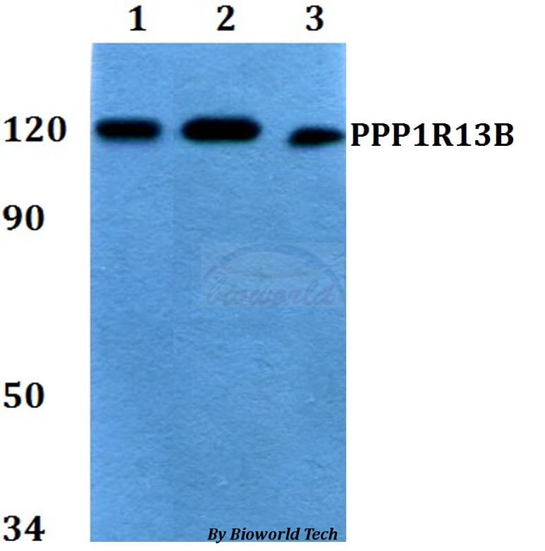 PPP1R13B Antibody