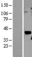 CYR61 Protein (Over-Expression Lysate Myc-DDK (Flag))