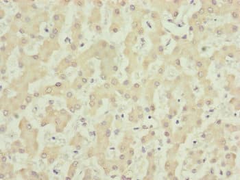 CDCA1 / NUF2 Antibody