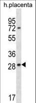 Polyclonal Rabbit anti-Human EAN57 Antibody (aa1-30, WB)