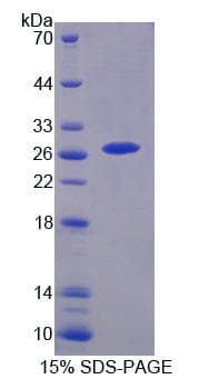 Human CHRNA3 Protein (Recombinant His-T7)