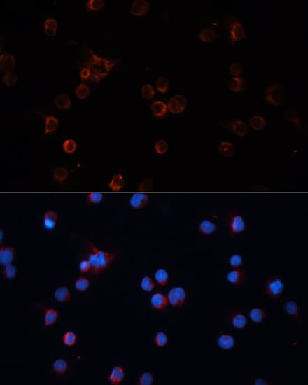 TH / Tyrosine Hydroxylase Antibody