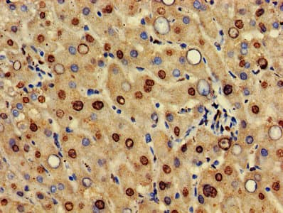 HIF3A / HIF3-Alpha Antibody