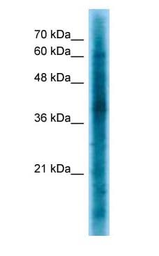 Polyclonal Rabbit anti-Human CRKL Antibody (aa183-232, IHC, WB)