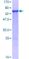 Human HMBS / PBGD Protein (Recombinant GST)