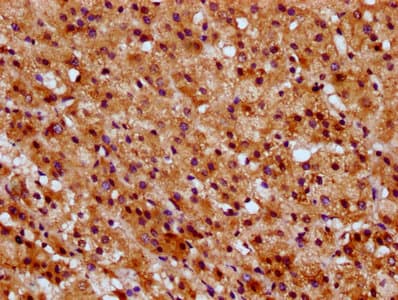 SUCLG1 / GALPHA Antibody