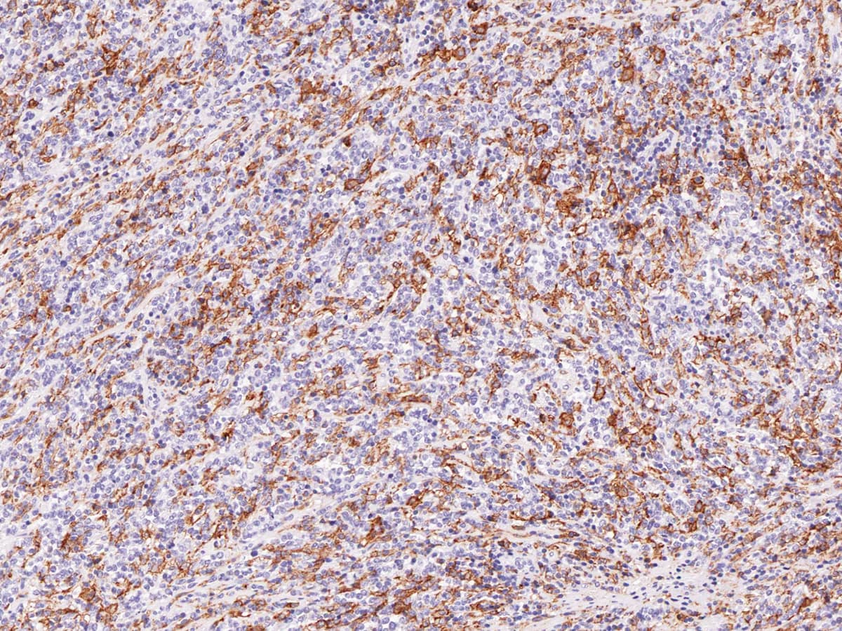 Monoclonal Mouse anti-Human Hairy Cell Leukemia Antibody (Ready-to-Use, IHC)
