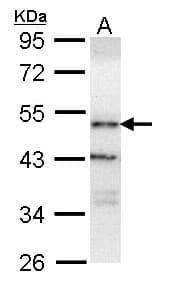 Polyclonal Rabbit anti-Human OSBPL1A / ORP1 Antibody (aa888-950, IHC, WB)
