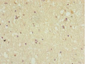 PPP2R5C Antibody